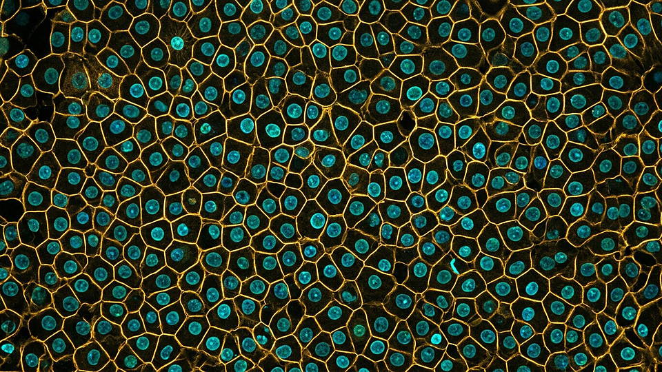 Illustration photoréaliste en lien avec la fiche « Cinquante-sept mille cellules » : Tapis dense de cellules humaines en fluorescence.